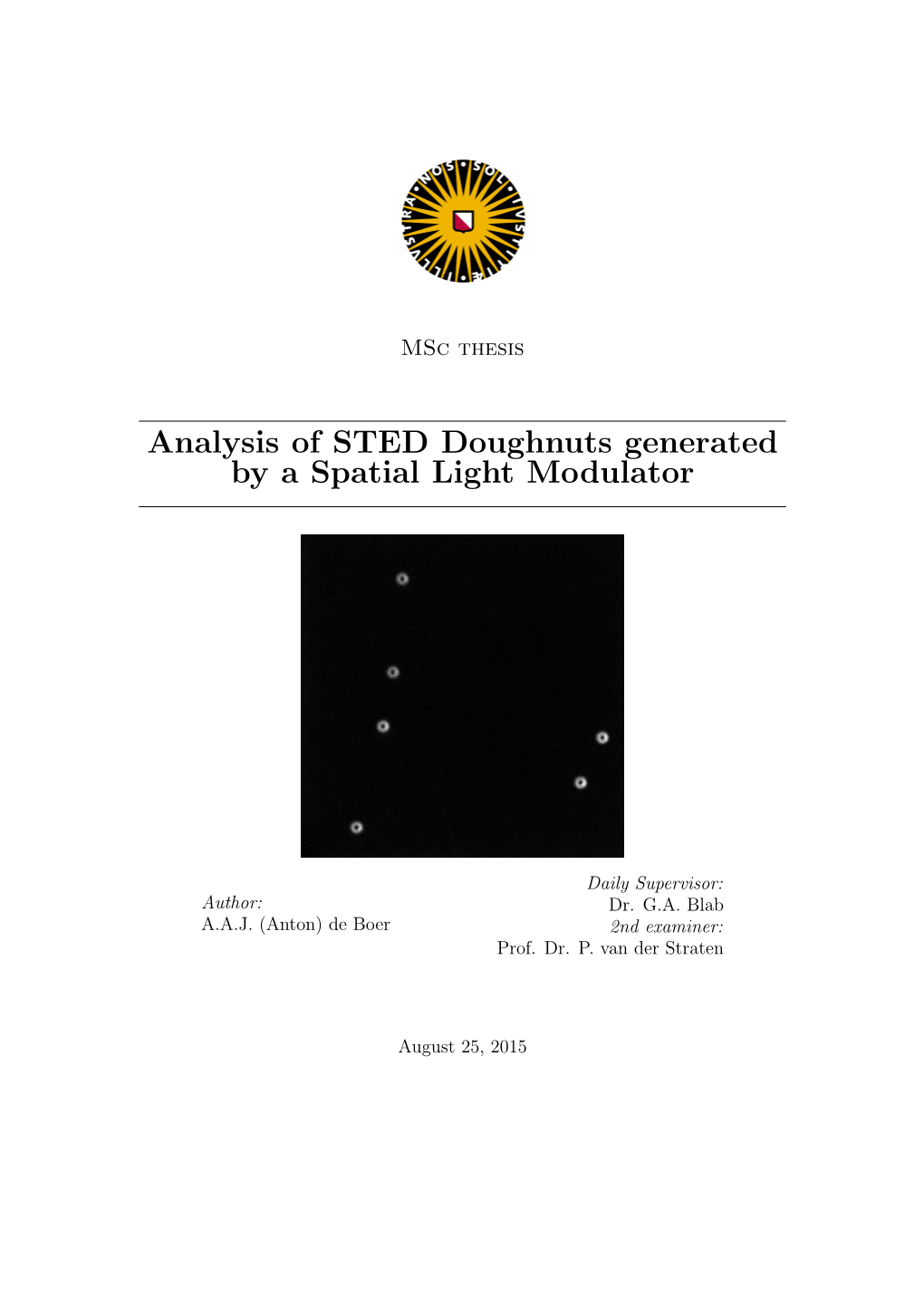 Analysis of STED Doughnuts Generated by a Spatial Light Modulator