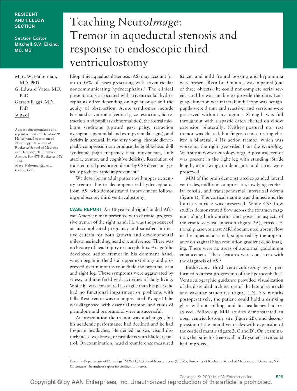 Tremor in Aqueductal Stenosis and Response to Endoscopic Third Ventriculostomy Marc W