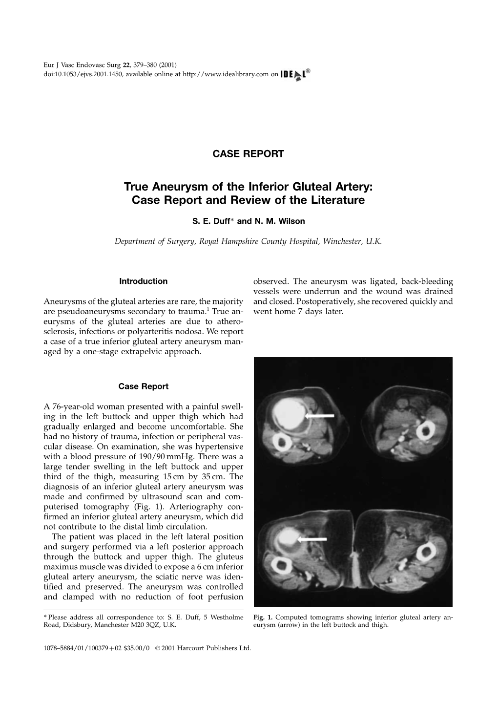 True Aneurysm of the Inferior Gluteal Artery: Case Report and Review of the Literature