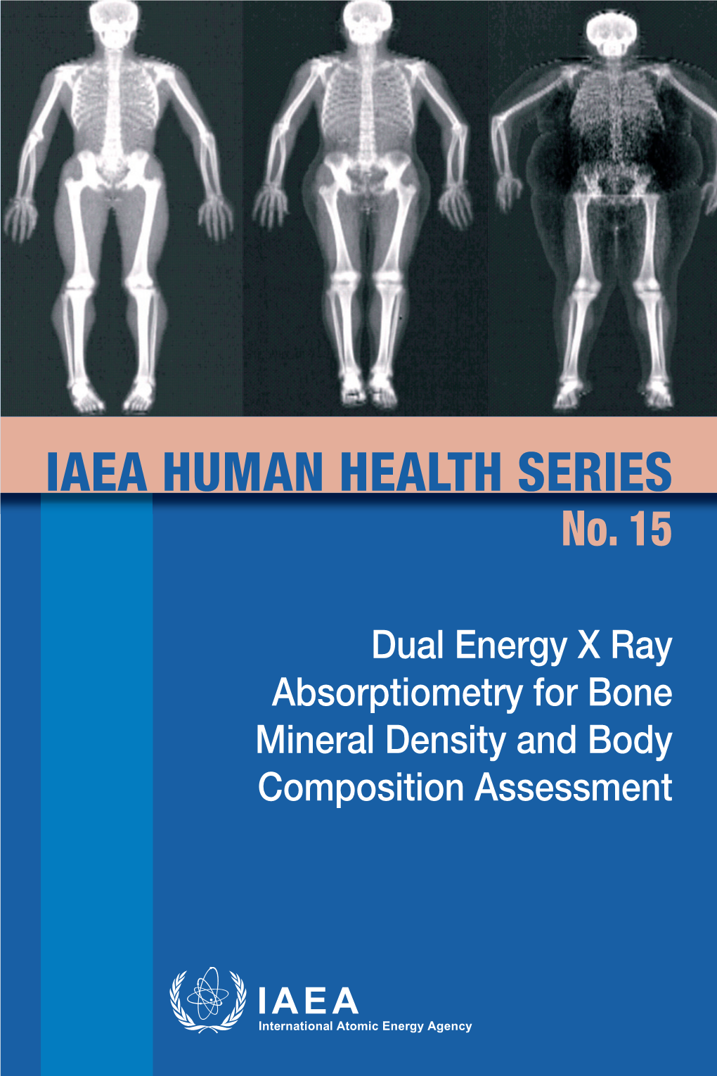 DUAL ENERGY X RAY ABSORPTIOMETRY for BONE MINERAL DENSITY and BODY COMPOSITION ASSESSMENT the Following States Are Members of the International Atomic Energy Agency