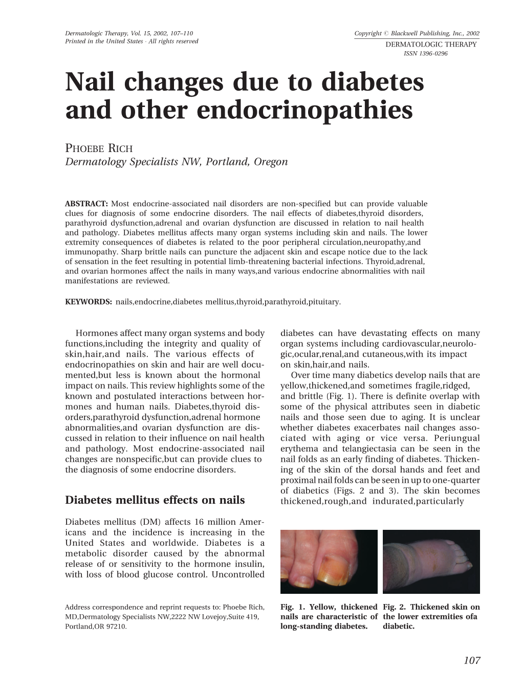 Nail Changes Due to Diabetes and Other Endocrinopathies