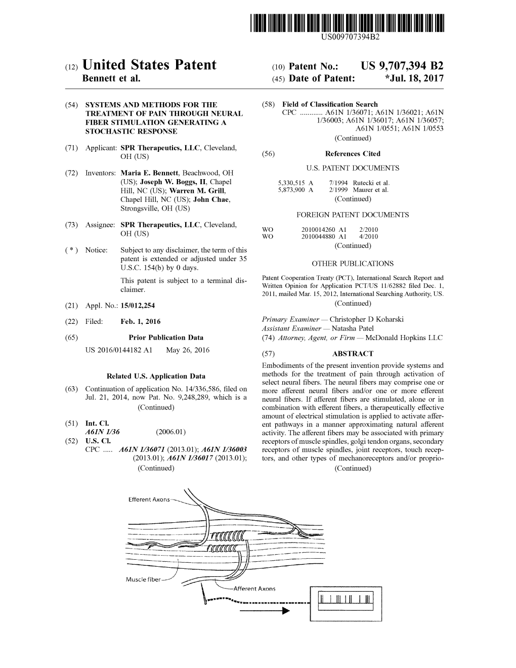 (12) United States Patent (10) Patent No.: US 9,707,394 B2 Bennett Et Al