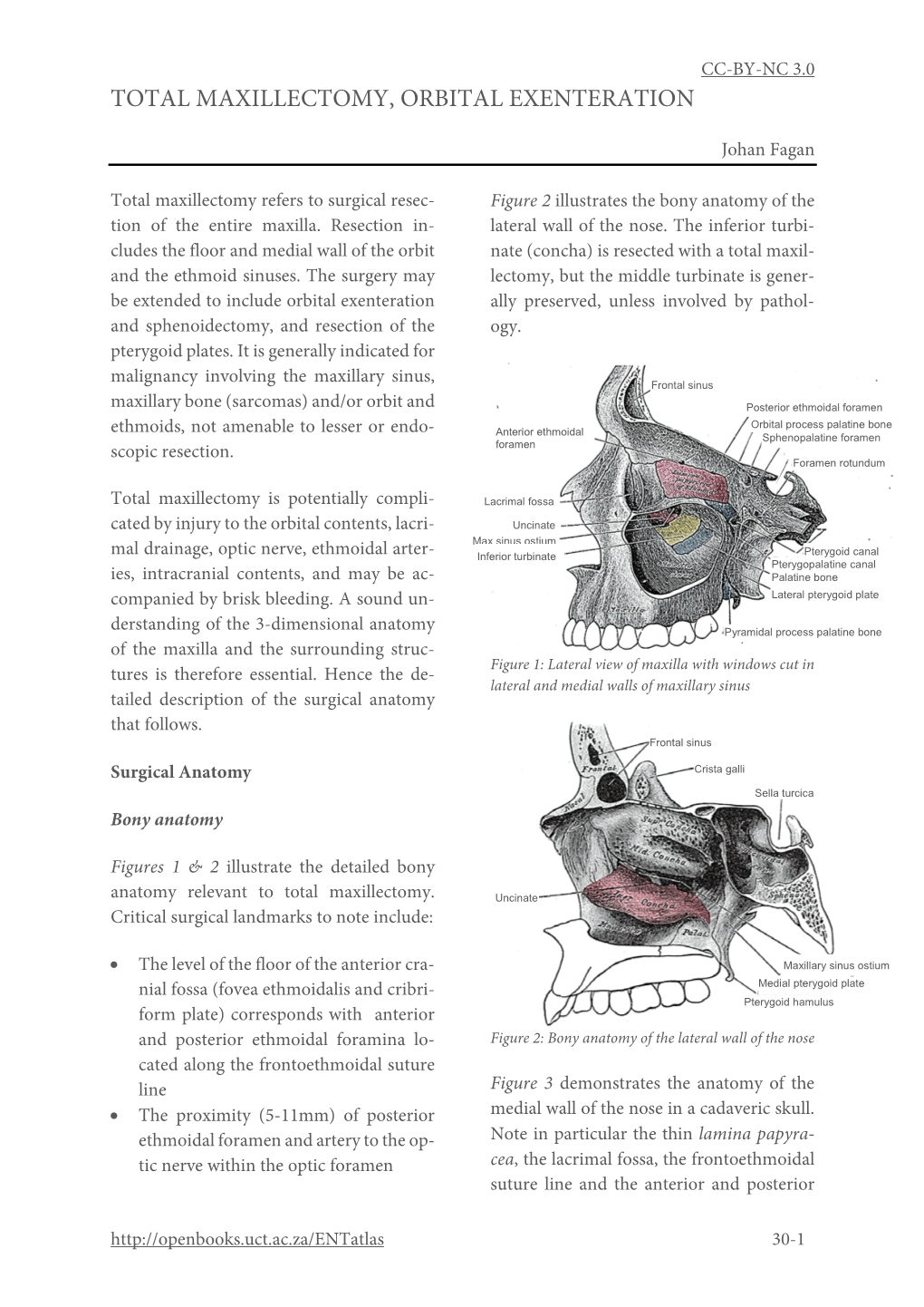 Total Maxillectomy and Orbital Exenteration