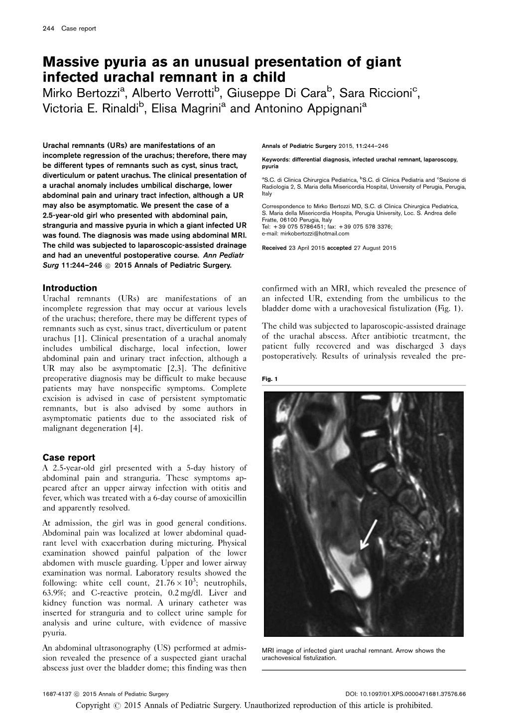 Massive Pyuria As an Unusual Presentation of Giant Infected