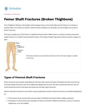 Femur Shaft Fractures (Broken Thighbone)