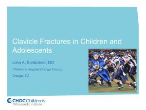 Clavicle Fractures in Children and Adolescents