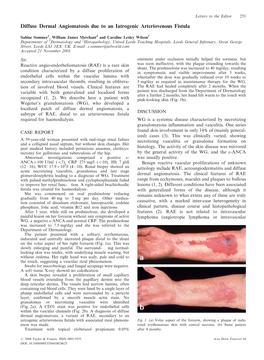 Diffuse Dermal Angiomatosis Due to an Iatrogenic Arteriovenous Fistula