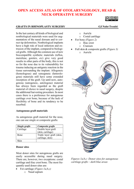 GRAFTS in RHINOPLASTY SURGERY GJ Nolst Trenité