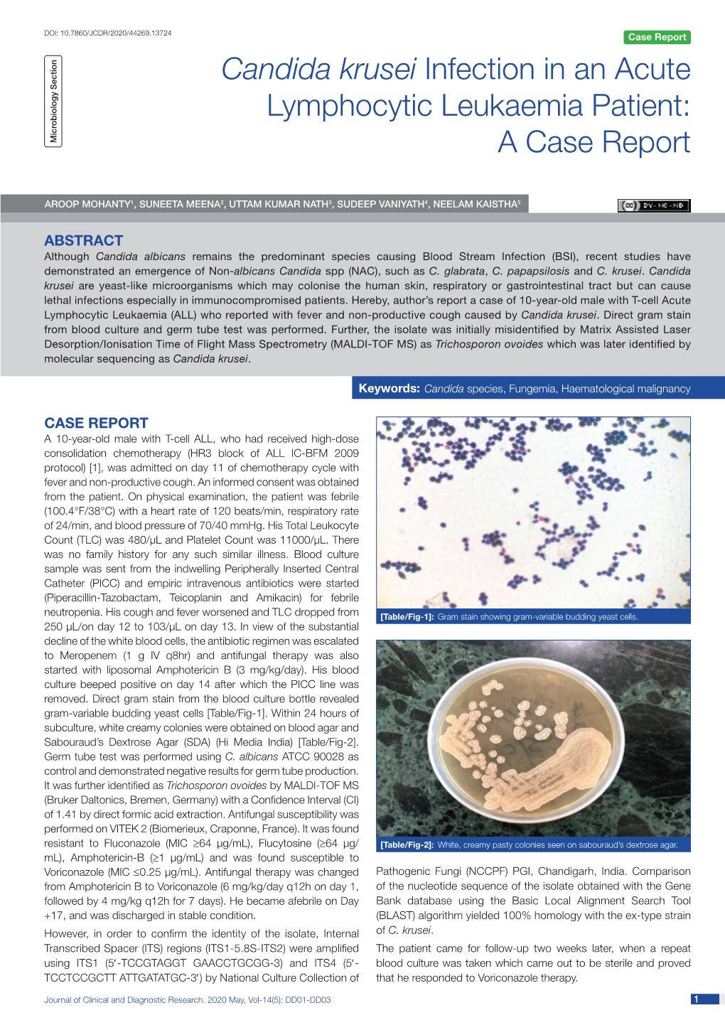 Candida Krusei Infection in an Acute Lymphocytic Leukaemia