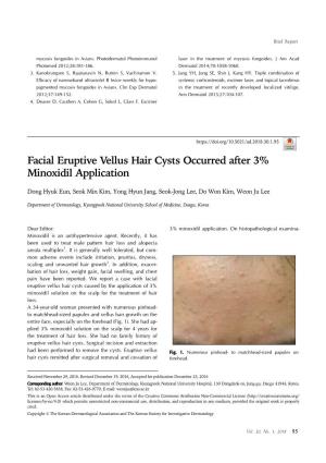 Facial Eruptive Vellus Hair Cysts Occurred After 3% Minoxidil Application
