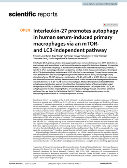 Interleukin-27 Promotes Autophagy in Human Serum-Induced
