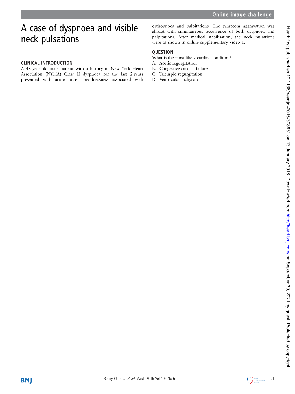 A Case of Dyspnoea and Visible Neck Pulsations