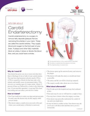 Let's Talk About Carotid Endarterectomy