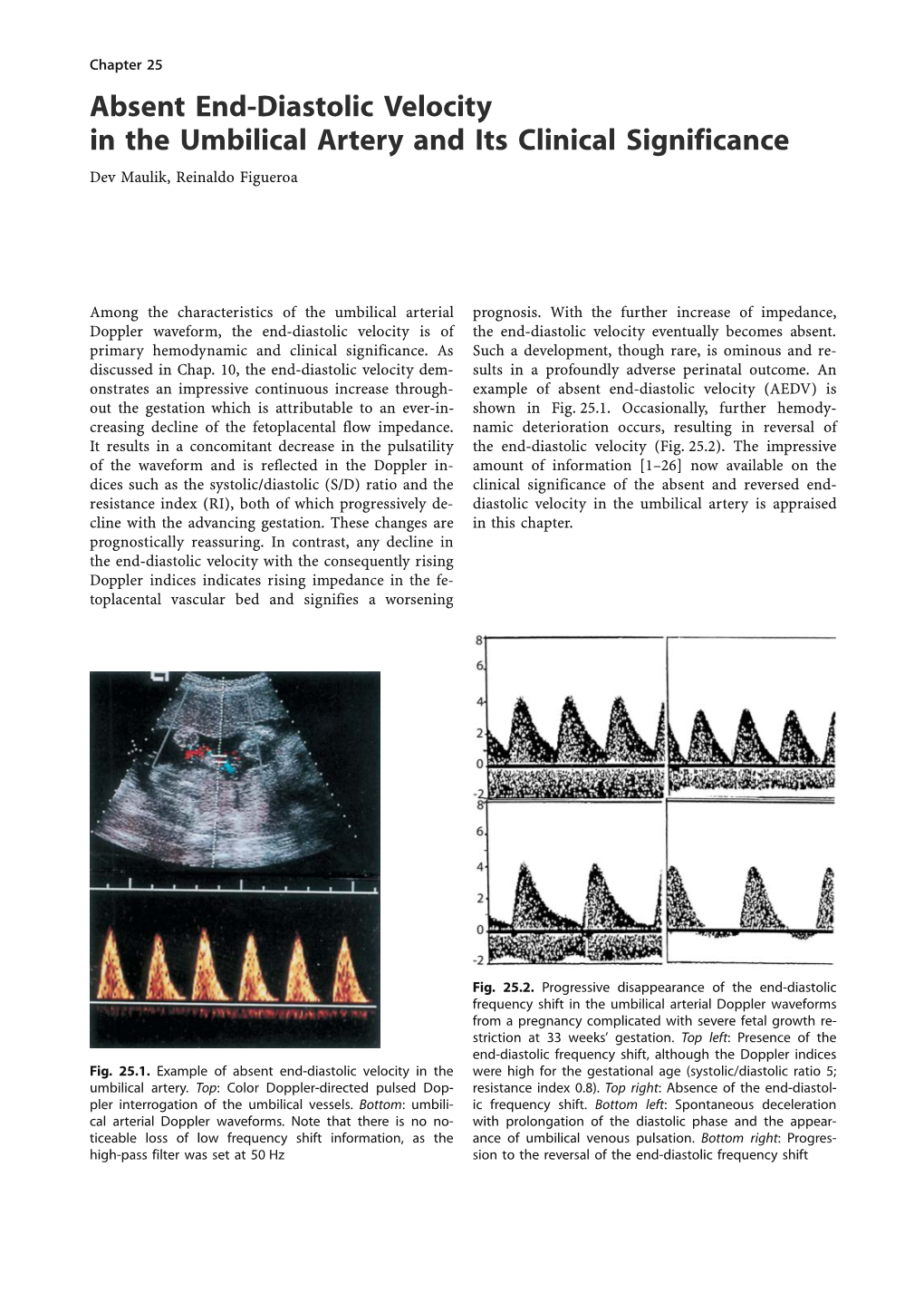 Absent End-Diastolic Velocity in the Umbilical Artery and Its Clinical Significance