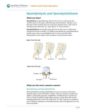 PE2841 Spondylolysis and Spondylolisthesis