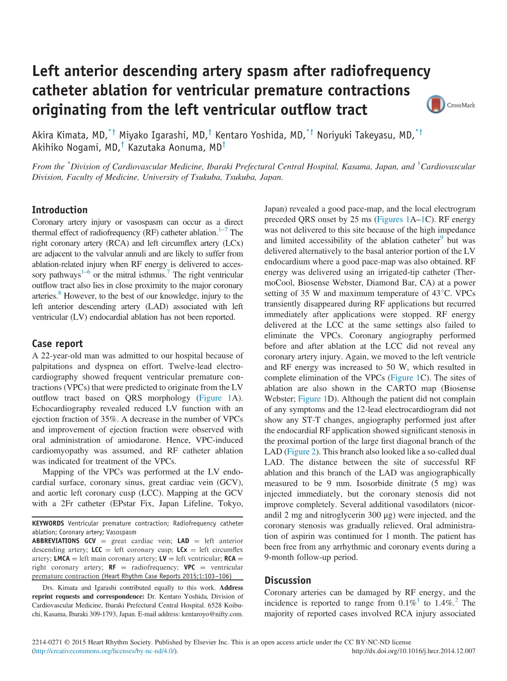 Left Anterior Descending Artery Spasm After Radiofrequency Catheter Ablation for Ventricular Premature Contractions Originating from the Left Ventricular Outﬂow Tract