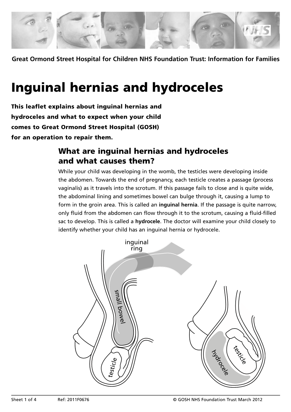 Inguinal Hernias and Hydroceles