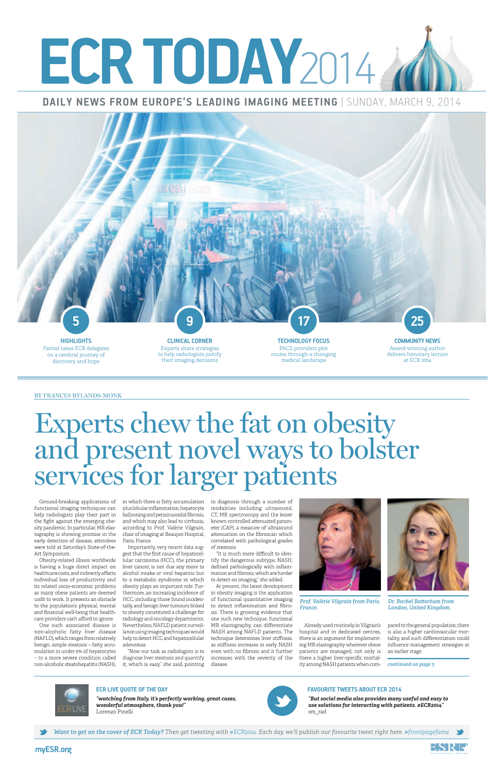 Experts Chew the Fat on Obesity and Present Novel Ways to Bolster Services for Larger Patients