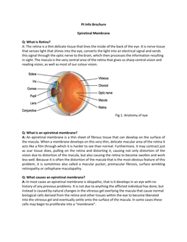 Epiretinal Membrane