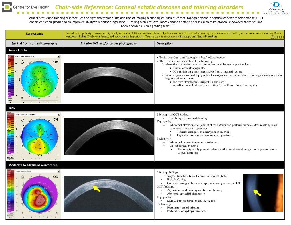 Chair-Side Reference: Corneal Ectatic Diseases and Thinning Disorders