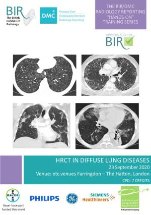 HRCT in DIFFUSE LUNG DISEASES 23 September 2020 Venue: Etc.Venues Farringdon – the Hatton, London CPD: 7 CREDITS