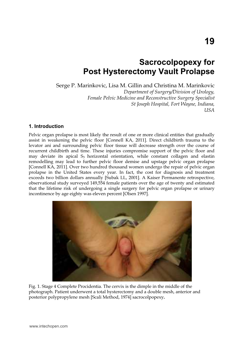 Sacrocolpopexy for Post Hysterectomy Vault Prolapse
