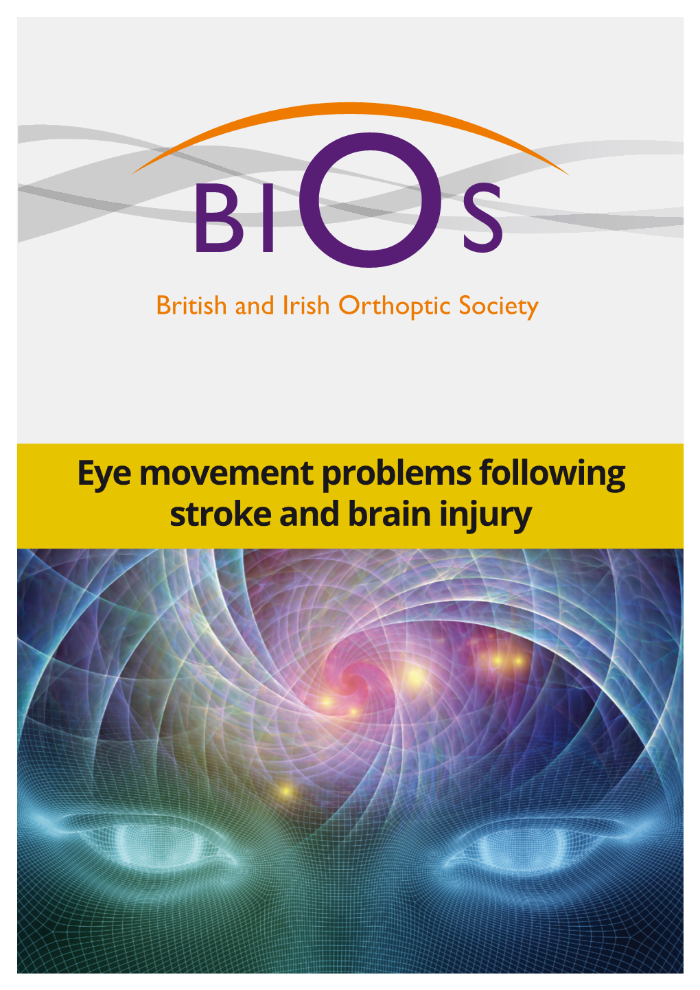 Eye Movement Problems Following Stroke and Brain Injury Eye Movement Problems Following Stroke and Brain Injury