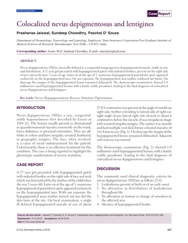 Colocalized Nevus Depigmentosus and Lentigines Prashansa Jaiswal, Sundeep Chowdhry, Paschal D’ Souza