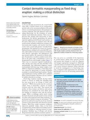 Contact Dermatitis Masquerading As Fixed Drug Eruption: Making a Critical Distinction Yasmin Hughes, Nicholas Comninos