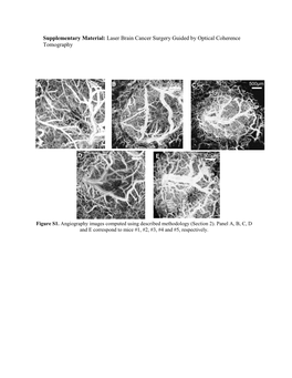 Laser Brain Cancer Surgery Guided by Optical Coherence Tomography