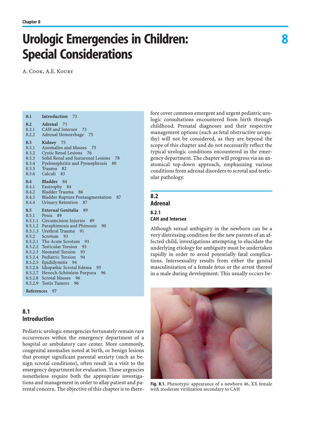8 Urologic Emergencies in Children: Special Considerations