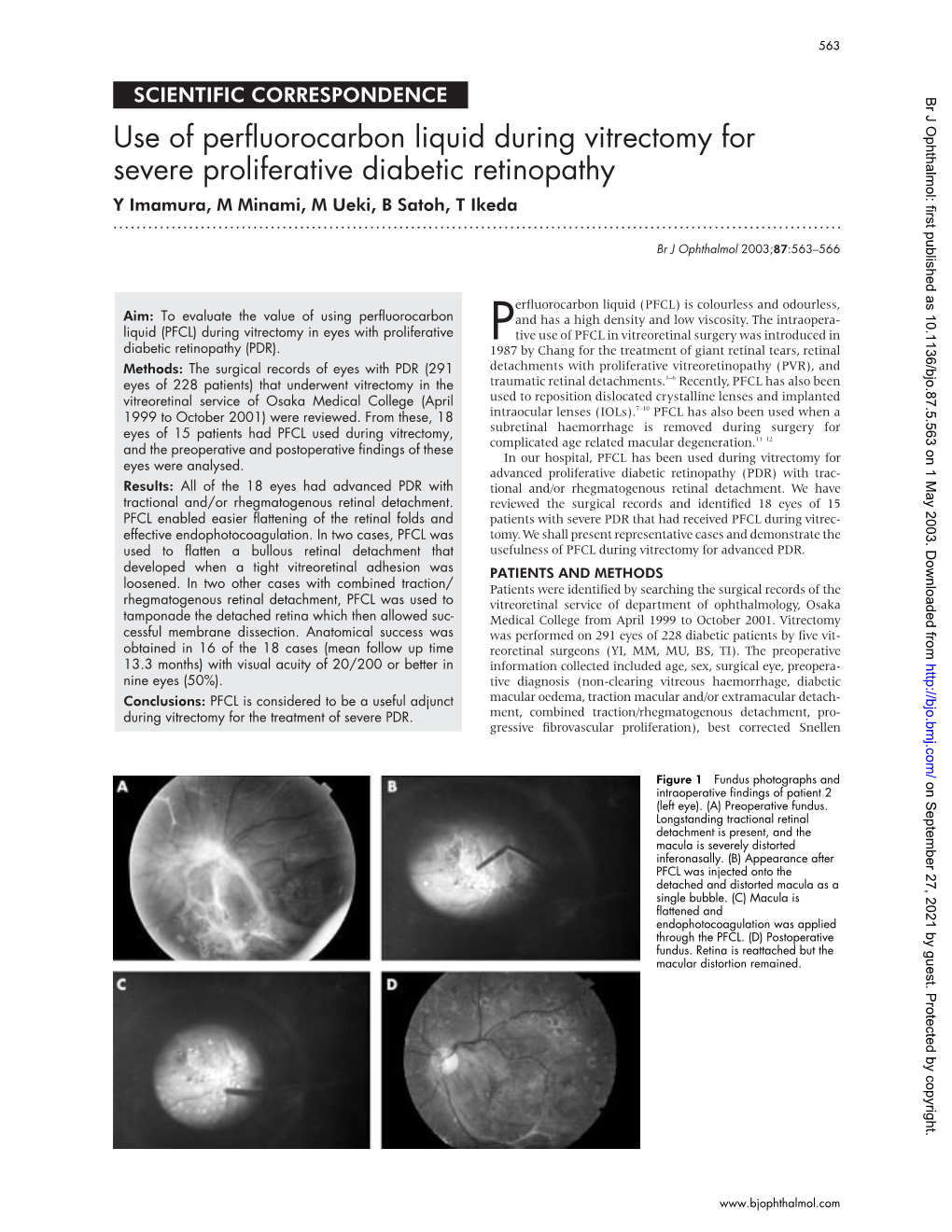 Use of Perfluorocarbon Liquid During Vitrectomy for Severe Proliferative Diabetic Retinopathy Y Imamura, M Minami, M Ueki, B Satoh, T Ikeda