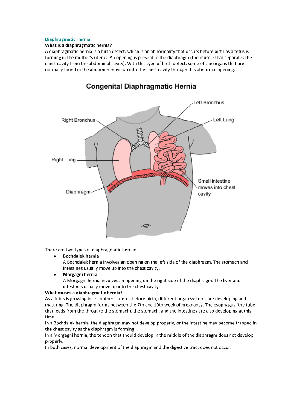 Diaphragmatic Hernia