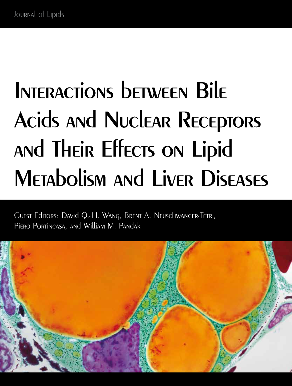 Interactions Between Bile Acids and Nuclear Receptors and Their Effects on Lipid Metabolism and Liver Diseases