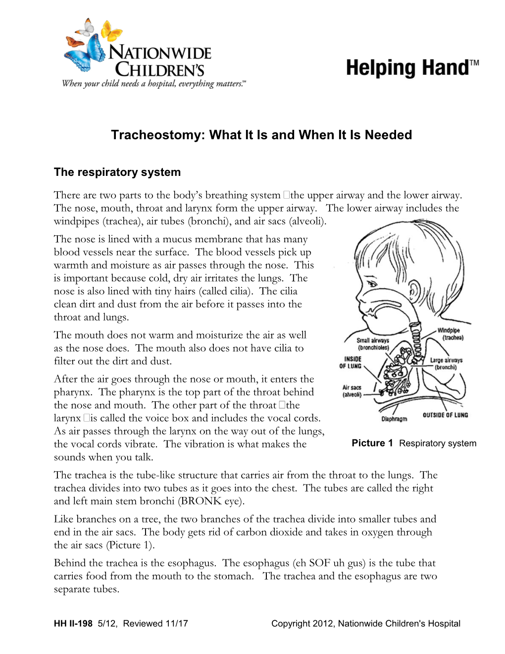 Tracheostomy: What It Is and When It Is Needed