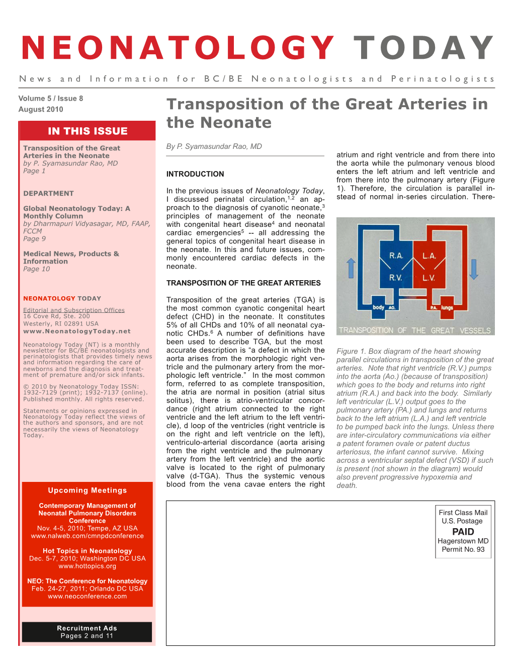 Transposition of the Great Arteries in the Neonate in THIS ISSUE