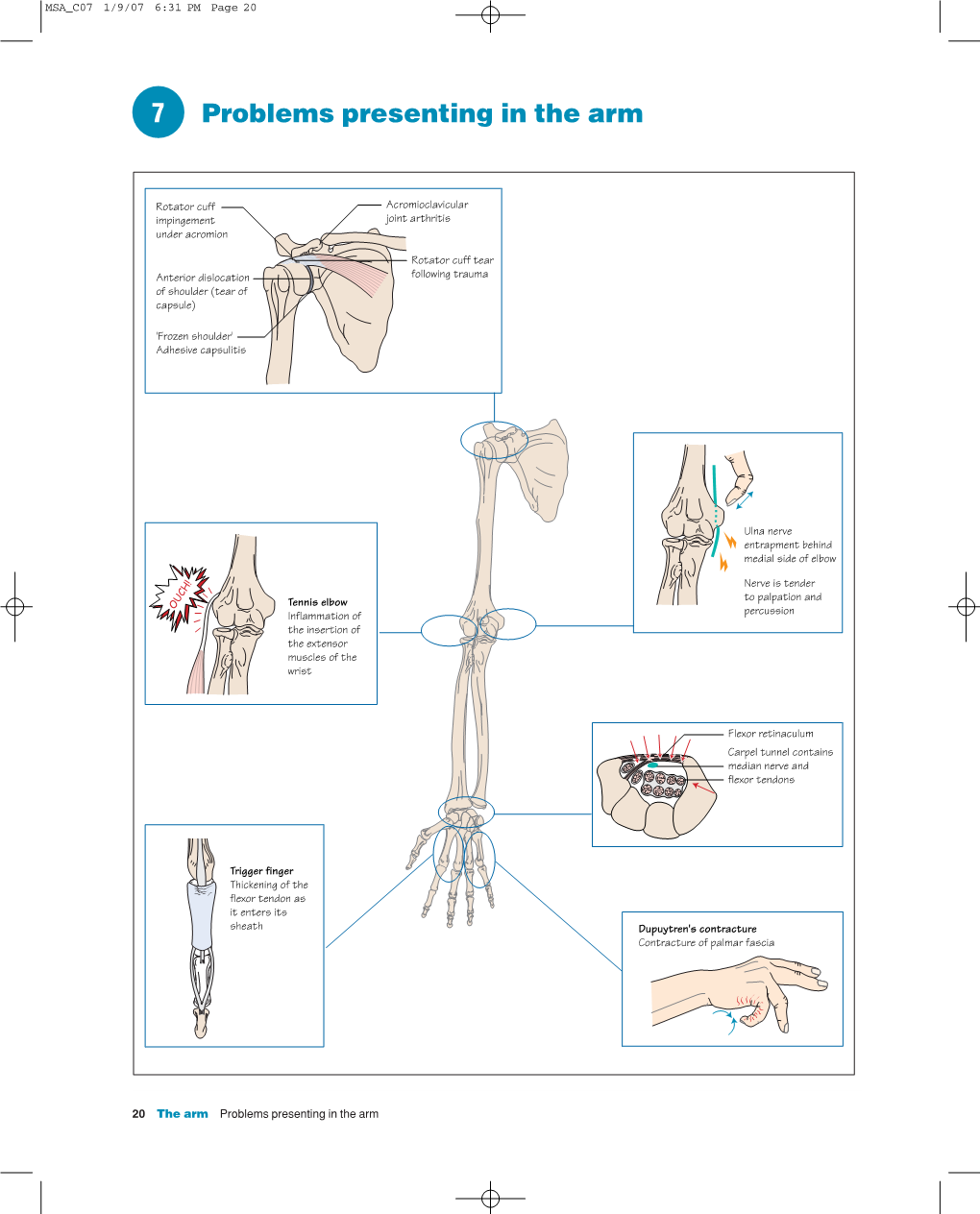 7 Problems Presenting in the Arm