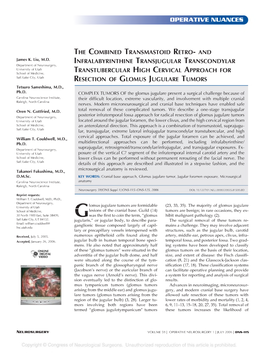 Designing Information-Preserving Mapping Schemes For