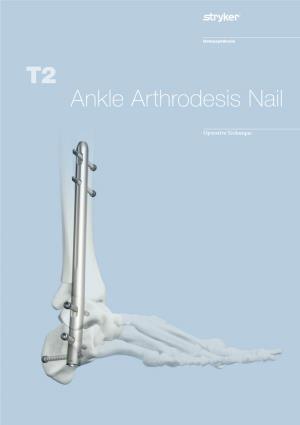 T2 Ankle Arthrodesis Nail