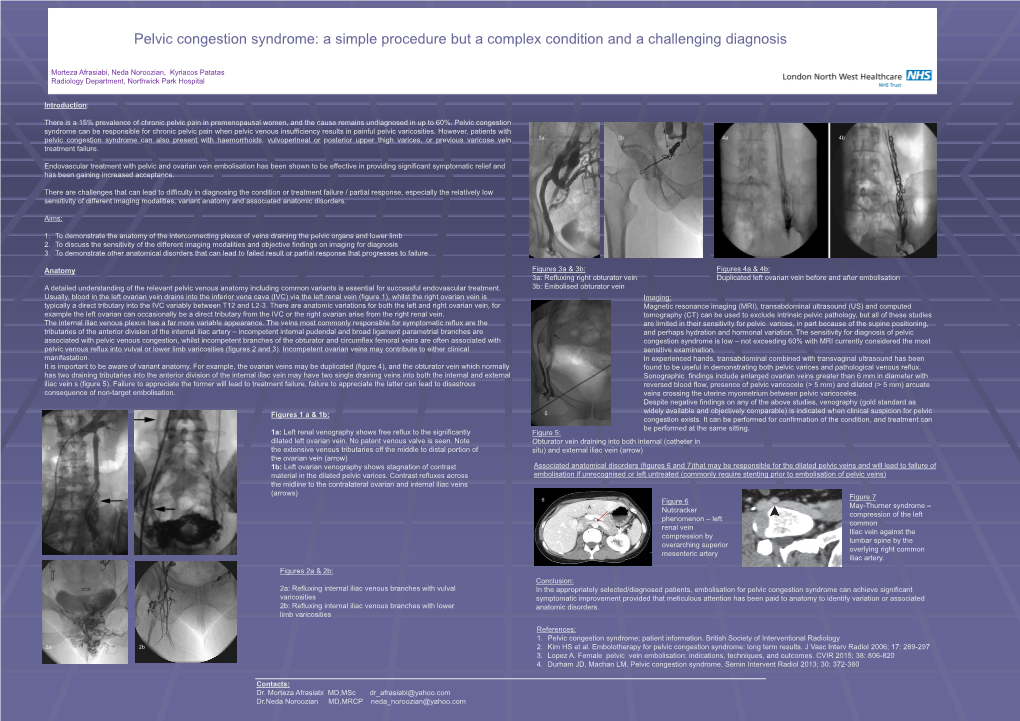 Pelvic Congestion Syndrome: a Simple Procedure but a Complex Condition and a Challenging Diagnosis