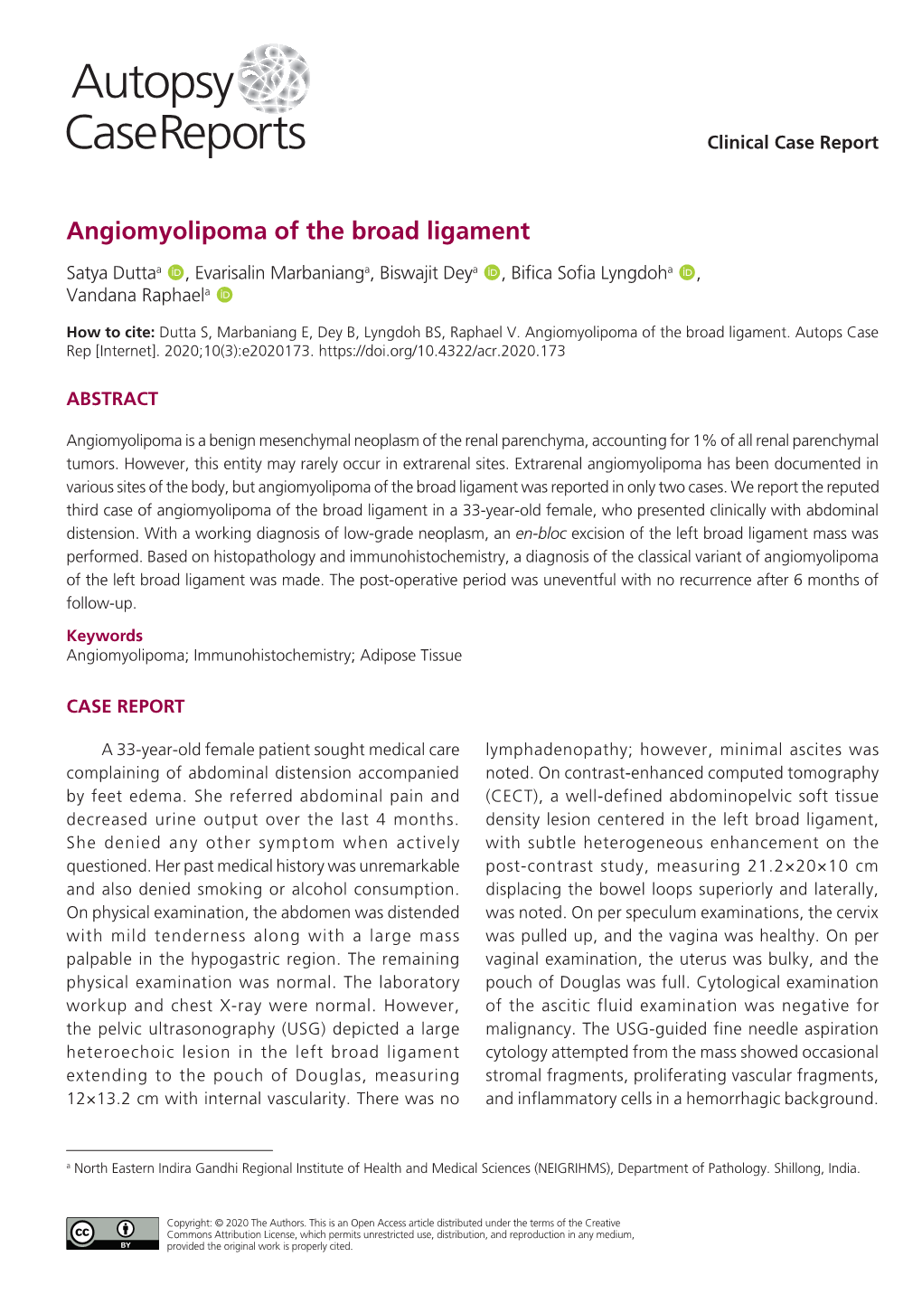 Angiomyolipoma of the Broad Ligament