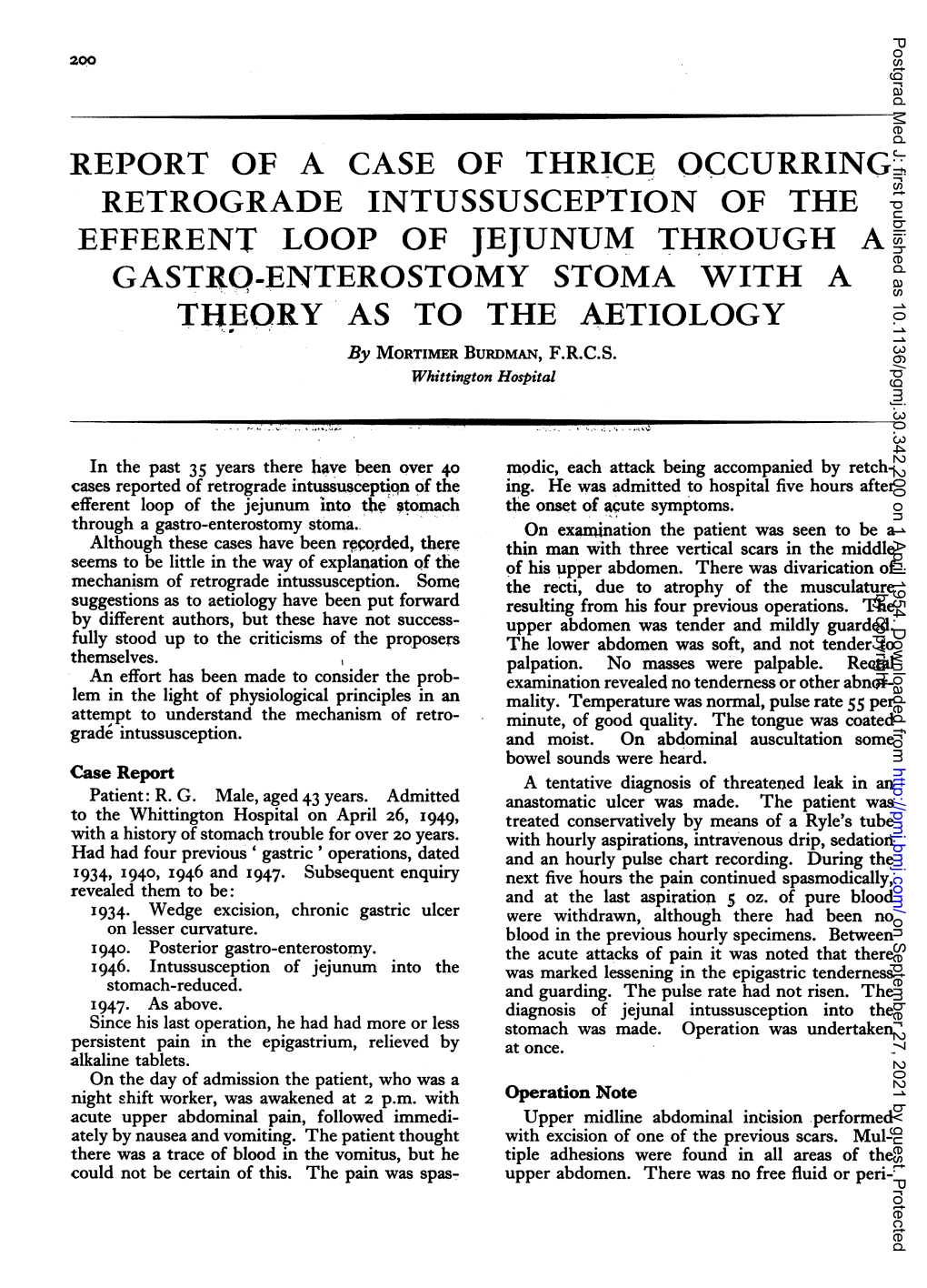 EFFERENT LOOP of JEJUNUM THROUGH a GASTRO-ENTEROSTOMY STOMA with a THEORY AS to the AETIOLOGY by MORTIMER BURDMAN, F.R.C.S