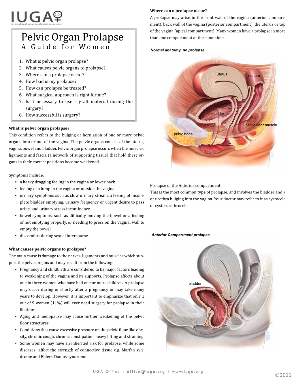 Pelvic Organ Prolapse Than One Compartment at the Same Time