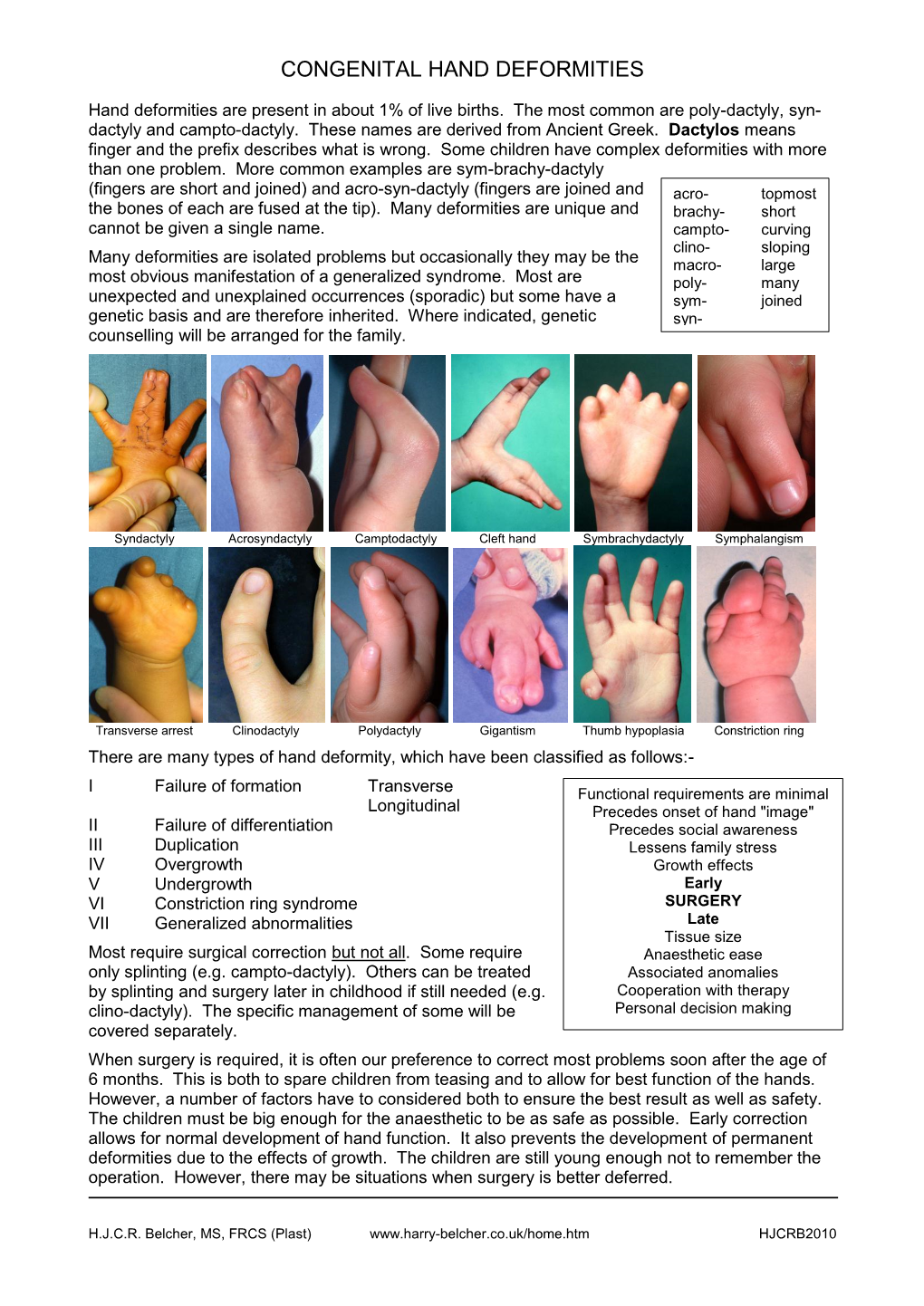 Congenital Hand Deformities