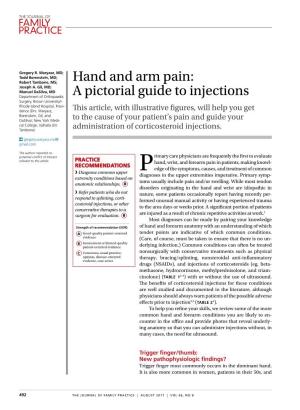 Hand and Arm Pain: Joseph A