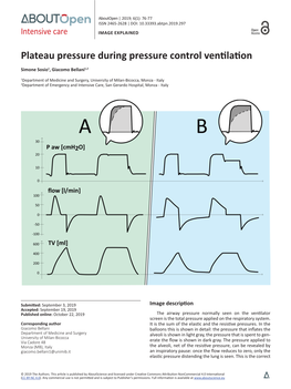 Plateau Pressure During Pressure Control Ventilation