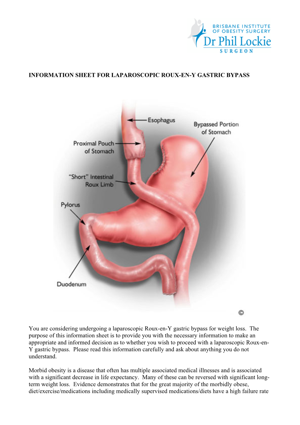 Information Sheet for Laparoscopic Roux-En-Y Gastric Bypass