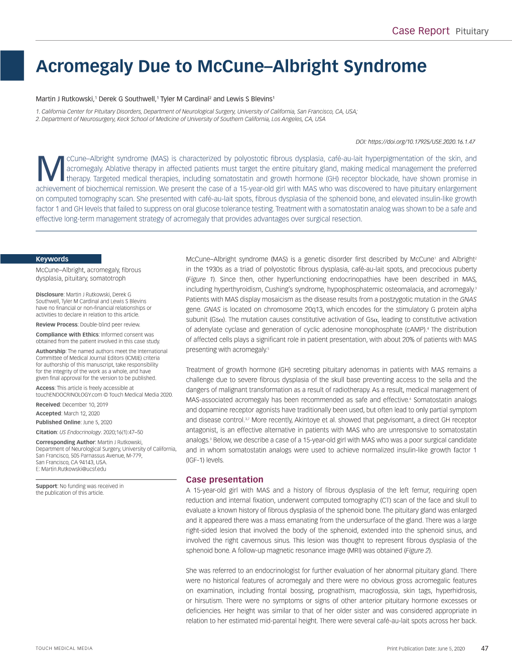 Acromegaly Due to Mccune–Albright Syndrome