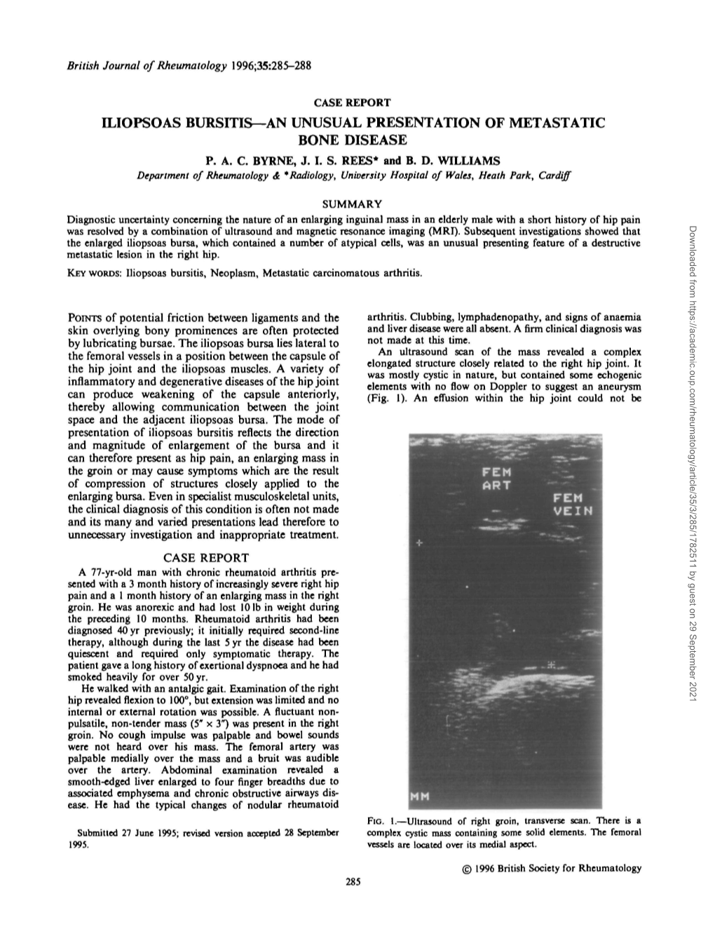 Iliopsoas Bursitis—An Unusual Presentation of Metastatic Bone Disease P