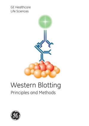 Western Blotting Principles and Methods